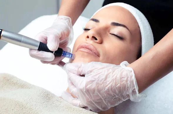 Microneedling München